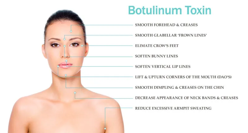 Schlankheitsmittel gegen Falten Beutox Batulaxs Resty Hautfüllmittel Juvederms 0